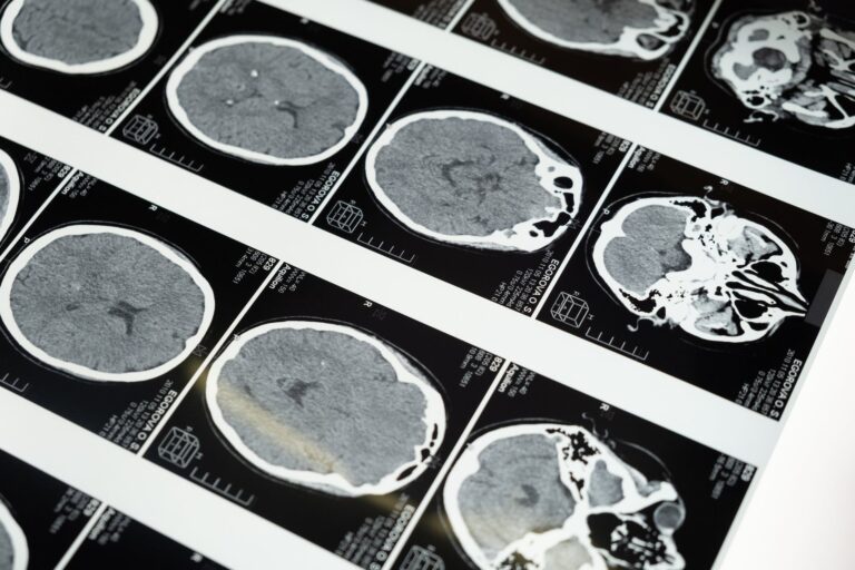Unveiling the Mysteries: The Science of Psychedelics